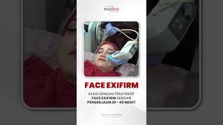 TREATMENT PENGHILANG DOUBLE CHIN #exifirmface