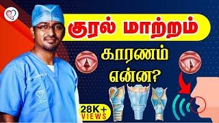 குரல் மாறுதல் - காரணம் என்ன ?  Vocal problem in Tamil  Dr. Manoj ENT Speciality Centre  Trichy