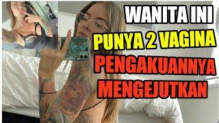 8 Foto Wanita yang Punya 2 Kelamin       Pengakuannya Mengejutkan