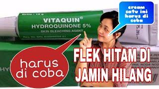 HARUS DI COBA⁉️ di jamin flek hitam bakal hilangcream VITAQUIN @ani family4567