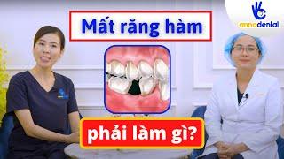 MẤT RĂNG HÀM THÌ PHẢI LÀM GÌ  Nha Khoa Anna