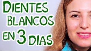 Dientes blancos en 3 días blanqueamiento dental natural y casero con aceite de coco