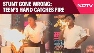 Fire Accident  Teen Catches Fire While Performing At An Event To Commemorate Actor Vijays Birthday