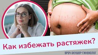 Растяжки во время беременности. Как избежать?  Виктория Матвиенко