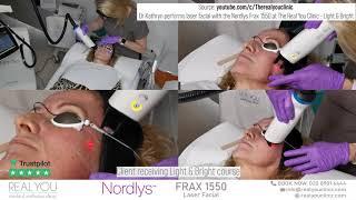 Nordlys Frax 1550 Testimonial - Instagram Clip - Real You Clinic