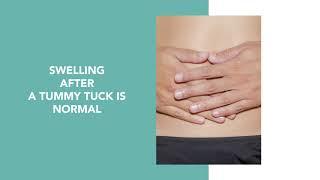 What’s the Real Story about Swelling after a Tummy Tuck?