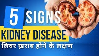 Kidney disease symptoms in Hindi  Kidney kharab hone ke lakshan  किडनी की बीमारी warning signs