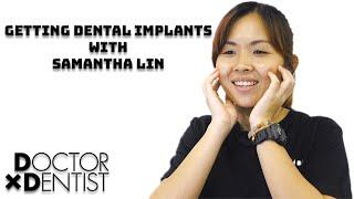 Getting Dental Implants with Samantha Lin at Elite Dental Group