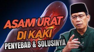 ASAM URAT DI KAKI PENYEBAB DAN SOLUSINYA