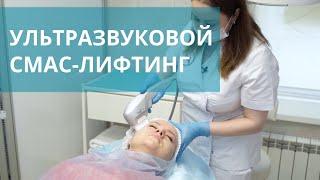  Ультразвуковой SMAS-лифтинг на аппарате Ультраформер — методика HIFU. СМАС-лифтинг Ультраформер.