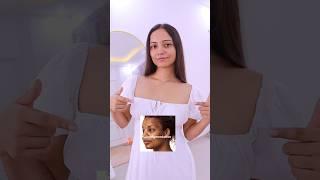 if you have HYPERPIGMENTATION follow these 3 steps  #ytshorts #shorts #skincare  Gulguli Singh