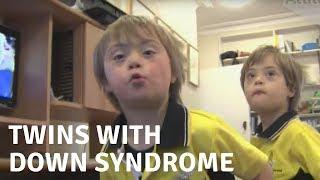 The Whittington Twins with Down Syndrome