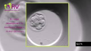 TimeLapse  Embryo development ENG first 100 hours