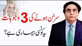 Dimag Sunn kyu hota hai? Brain Weakness Symptoms  By Dr. Khalid Jamil