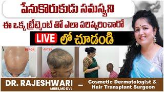 Alopecia Universalis Hair Regrowth  PRP Treatment After Alopecia Universalis  Dr Rajeshwari