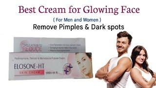 Best face cream for glowing Skin  Remove Pimples Darkspots & Dark circles  Elosone-HT