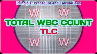 Total Leukocyte Count  TLC Blood Test Procedure  Total WBC Count Experiment