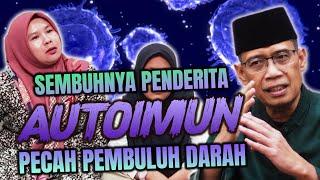 SEMBUHNYA  PENDERITA AUTOIMUN PECAH PEMBULUH DARAH