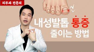 내성발톱 집에서 통증 줄이는 방법  간편하게 덜 아프기 피부과전문의 피부심