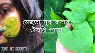 মেছতার দাগ দূর করার উপায়  মেছতার চিকিৎসায় ঔষধি পাতার ব্যবহার   Melasma Treatment in Bangla