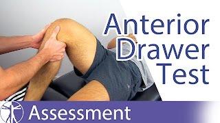 Anterior Drawer Test  Anterior Cruciate Ligament Rupture