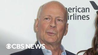 Bruce Willis diagnosed with aphasia stepping away from acting