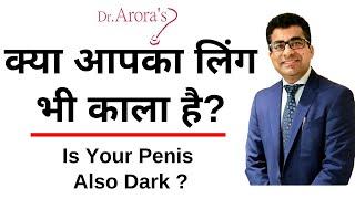 Is Your Penis Also Dark ? क्या आपका लिंग भी काला है? Sex Education - Penis Myths - Sexual Health Tip