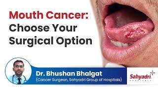 Mouth Cancer Choose Your Surgical Option  Dr Bhushan Bhalgat