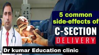 5 COMMON SIDE-EFFECTS OF C-SECTION DELIVERY \\ Dr kumar Education clinic
