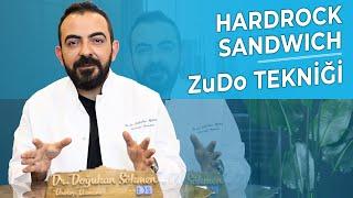 Penis Uzatma ve Penis Kalınlaştırma Ameliyatı  Hardrock Sandviç - Zudo Tekniği