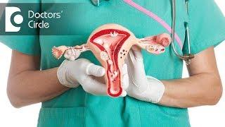 Treating heavy bleeding due to Fibroids without removing uterus - Dr. Nupur Sood