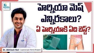 హెర్నియాకి ఏ మెష్ బెస్ట్?  What is the Best Mesh for Hernia Surgery?  Dr Abhilash Nali