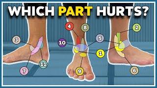 My ankle hurts here 11 typical pain spots and what they mean