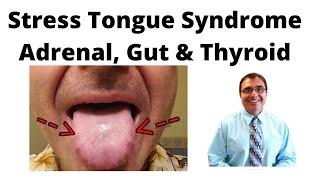 Stress Tongue Syndrome Adrenal Gut & Thyroid