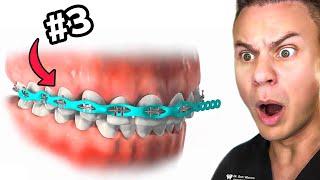 Top 5 Most PAINFUL Things About Braces