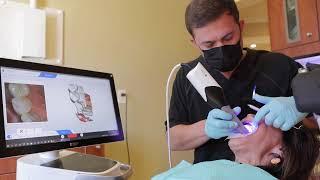 Primescan Intraoral Scanning vs. Traditional Impressions