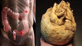  I expelled 7 kg of poison from my intestines Body cleansing and detoxification