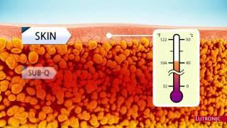 enCurve How Does Radio Frequency Fat Removal Work