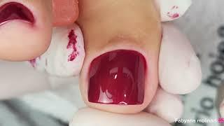 transformação das unhas dos pés essa cutícula é fina e fácil de tirar 