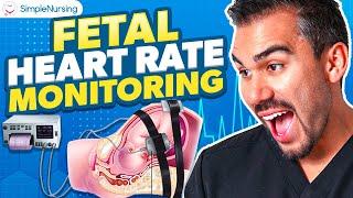 Fetal Heart Rate Monitor for Nursing  Decelerations Key Terms NCLEX