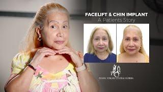 Facelift & Chin Implant Orlando FL  Actual Patient Story