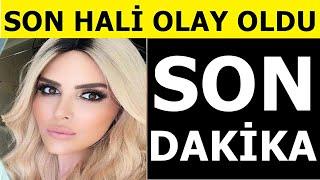 Selin Ciğercinin son hali tanınmaz halde