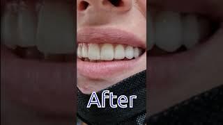 Zykova dentist before after