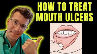 How to recognise and treat Mouth Ulcers getting rid of canker sores  Doctor ODonovan explains...