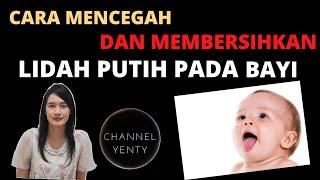 Cara Mengatasi Dan Membersihkan Lidah Putih Pada Bayi  Membersihkan Selaput Putih Pada Mulut Bayi