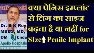 क्या पेनिस इम्प्लांट से लिंग का साइज बढ़ता है या नहीं  Penis implant for Penis Enlargement Length DR