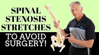 Best 3 Stretches To Quickly Remedy Lumbar Spinal Stenosis & Avoid Surgery