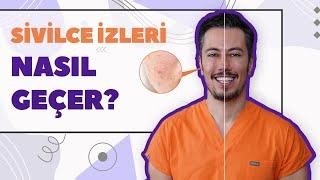 Sivilce İzleri Nasıl Geçer? Akne İzleri Tedavisi