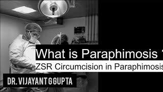 What is Paraphimosis  ZSR Circumcision in Paraphimosis