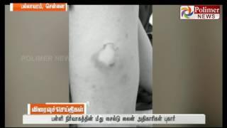 Chennai  LKG kid tortured by teachers and got injured  Child Line files complaint against teachers